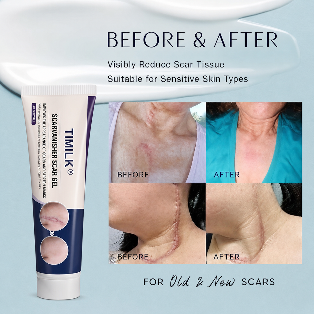 COMBO TIMILK Scar Vanisher Gel – Advanced Silicone Formula for Scars, Stretch Marks & Smooth Skin (Before & After Results)