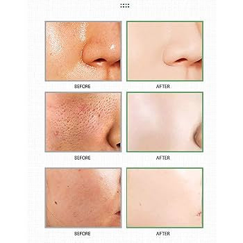 Madagascar Centella Clay Stick Mask - For Quick Pore Minimizing & whiteheads/Blackheads cleaning