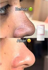 Madagascar Centella Clay Stick Mask - For Quick Pore Minimizing & whiteheads/Blackheads cleaning