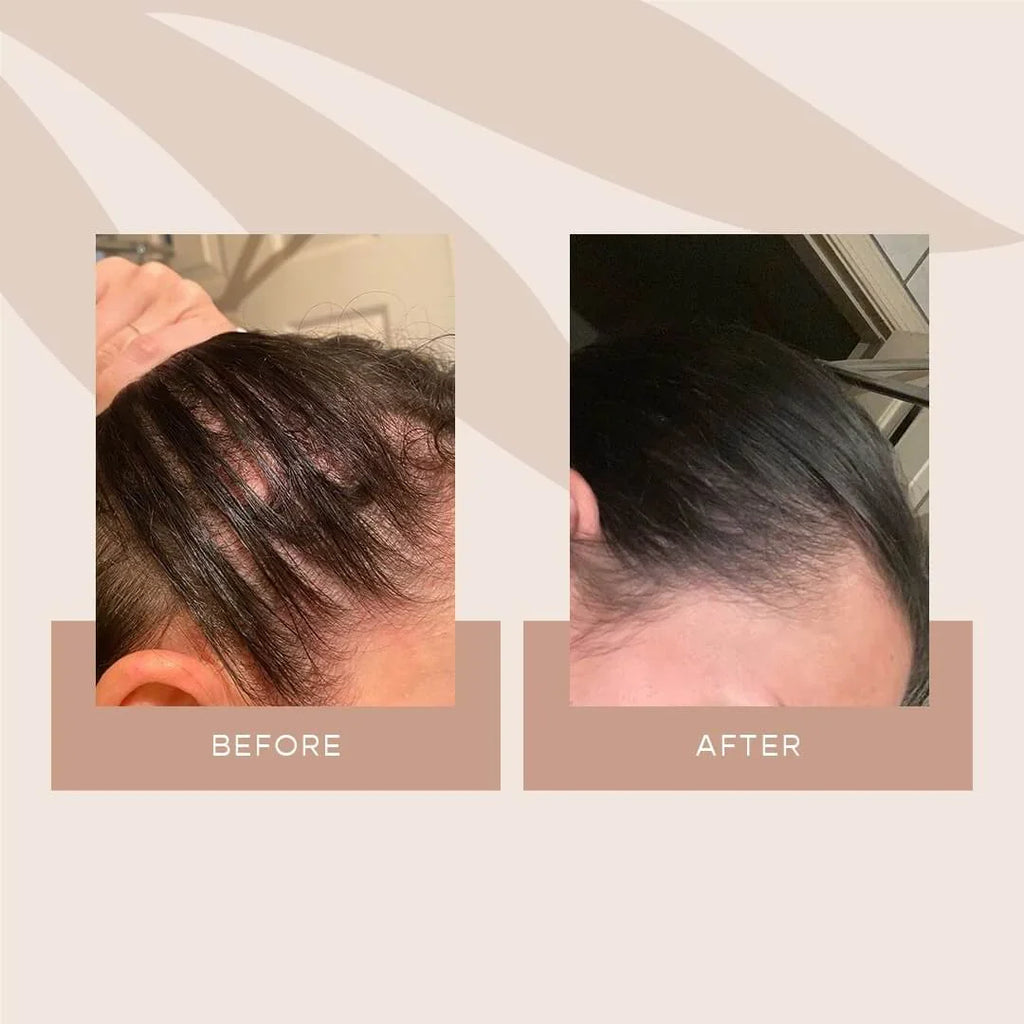 Rivaaj Mahal Herbal Hair Oil | 100% Natural Formula with 20+ Herbs | Reduces Hair Fall, Promotes Growth & Fights Dandruff